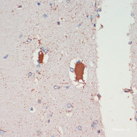 Immunohistochemistry of paraffin-embedded Rat brain using LRRK2 Polyclonal Antibody at dilution of 1:200 (40x lens) .
