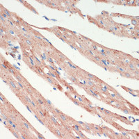 Immunohistochemistry of paraffin-embedded Rat heart using LRRK2 Polyclonal Antibody at dilution of 1:200 (40x lens) .