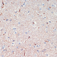 Immunohistochemistry of paraffin-embedded Mouse spinal cord using LRRK2 Polyclonal Antibody at dilution of 1:200 (40x lens) .