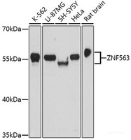 Western blot analysis of extracts of various cell lines using ZNF563 Polyclonal Antibody at dilution of 1:1000.