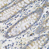Immunohistochemistry of paraffin-embedded Human colon using PLGF Polyclonal Antibody at dilution of 1:100 (40x lens) .
