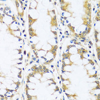 Immunohistochemistry of paraffin-embedded Human colon using BLOC1S3 Polyclonal Antibody at dilution of 1:100 (40x lens) .