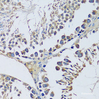 Immunohistochemistry of paraffin-embedded Mouse testis using BLOC1S3 Polyclonal Antibody at dilution of 1:100 (40x lens) .