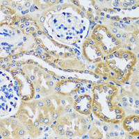 Immunohistochemistry of paraffin-embedded Mouse kidney using BLOC1S3 Polyclonal Antibody at dilution of 1:100 (40x lens) .
