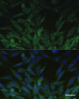 Immunofluorescence analysis of NIH-3T3 cells using BLOC1S3 Polyclonal Antibody at dilution of 1:100. Blue: DAPI for nuclear staining.