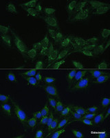 Immunofluorescence analysis of U-2 OS cells using BLOC1S3 Polyclonal Antibody at dilution of 1:100. Blue: DAPI for nuclear staining.