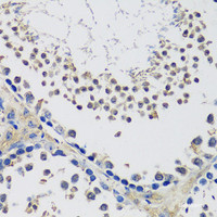 Immunohistochemistry of paraffin-embedded Mouse testis using C10orf62 Polyclonal Antibody at dilution of 1:100 (40x lens) .
