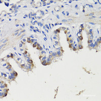 Immunohistochemistry of paraffin-embedded Rat bronchus using DEPDC6 Polyclonal Antibody at dilution of 1:200 (40x lens) .