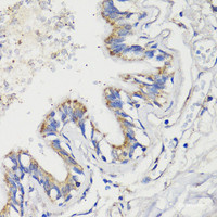 Immunohistochemistry of paraffin-embedded Human lung using DEPDC6 Polyclonal Antibody at dilution of 1:200 (40x lens) .