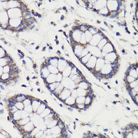 Immunohistochemistry of paraffin-embedded Human colon using DEPDC6 Polyclonal Antibody at dilution of 1:200 (40x lens) .