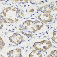 Immunohistochemistry of paraffin-embedded Human stomach using DEPDC6 Polyclonal Antibody at dilution of 1:200 (40x lens) .