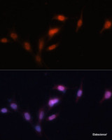 Immunofluorescence analysis of NIH-3T3 cells using SIRT1 Polyclonal Antibody at dilution of 1:100. Blue: DAPI for nuclear staining.