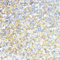Immunohistochemistry of paraffin-embedded Human tonsil using MLKL Polyclonal Antibody at dilution of 1:200 (40x lens) .