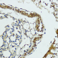 Immunohistochemistry of paraffin-embedded Mouse lung using MLKL Polyclonal Antibody at dilution of 1:200 (40x lens) .