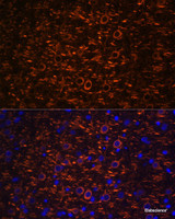 Immunofluorescence analysis of Rat brain cells using Map2 Polyclonal Antibody at dilution of 1:100. Blue: DAPI for nuclear staining.