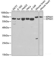 Western blot analysis of extracts of various cell lines using KPNA1 Polyclonal Antibody at dilution of 1:1000.