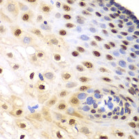 Immunohistochemistry of paraffin-embedded Human esophagus using KPNA1 Polyclonal Antibody at dilution of 1:100 (40x lens) .