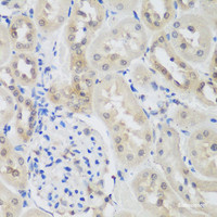 Immunohistochemistry of paraffin-embedded Rat kidney using UBE3A Polyclonal Antibody at dilution of 1:200 (40x lens) .