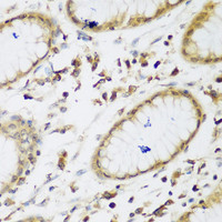 Immunohistochemistry of paraffin-embedded Human gastric using UBE3A Polyclonal Antibody at dilution of 1:200 (40x lens) .