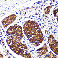 Immunohistochemistry of paraffin-embedded Human stomach using CNR2 Polyclonal Antibody at dilution of 1:150 (40x lens) .