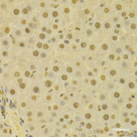 Immunohistochemistry of paraffin-embedded Human liver using COPS5 Polyclonal Antibody at dilution of 1:100 (40x lens) .