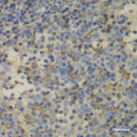 Immunohistochemistry of paraffin-embedded Human amygdalitis using FTL Polyclonal Antibody at dilution of 1:100 (40x lens) .