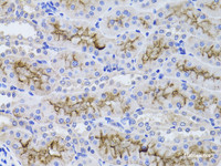 Immunohistochemistry of paraffin-embedded Rat kidney using GGT1 Polyclonal Antibody at dilution of 1:100 (40x lens) .