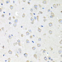 Immunohistochemistry of paraffin-embedded Mouse brain using CTSK Polyclonal Antibody at dilution of 1:100 (40x lens) .