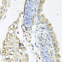 Immunohistochemistry of paraffin-embedded Mouse lung using CTSK Polyclonal Antibody at dilution of 1:100 (40x lens) .