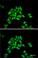 Immunofluorescence analysis of HeLa cells using DCTN1 Polyclonal Antibody