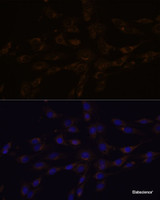 Immunofluorescence analysis of C6 cells using RGS4 Polyclonal Antibody at dilution of 1:100. Blue: DAPI for nuclear staining.