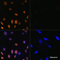 Immunofluorescence analysis of NIH/3T3 cells using Acetyl-Histone H3-K9/K14/K18/K23/K27 Polyclonal Antibody at dilution of 1:100. Blue: DAPI for nuclear staining.NIH/3T3 cells were treated by TSA (1 uM) at 37℃ for 18 hours. Blue: DAPI for nuclear staining.