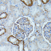 Immunohistochemistry of paraffin-embedded Rat kidney using PDE3A Polyclonal Antibody at dilution of 1:100 (40x lens) .