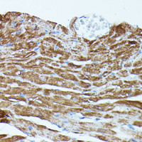 Immunohistochemistry of paraffin-embedded Mouse heart using PDE3A Polyclonal Antibody at dilution of 1:100 (40x lens) .