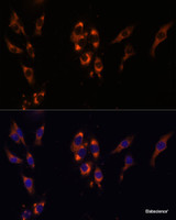 Immunofluorescence analysis of HeLa cells using PDE3A Polyclonal Antibody at dilution of 1:100 (40x lens) . Blue: DAPI for nuclear staining.