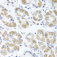 Immunohistochemistry of paraffin-embedded Human stomach using ACP1 Polyclonal Antibody at dilution of 1:100 (40x lens) .