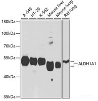 Western blot analysis of extracts of various cell lines using ALDH1A1 Polyclonal Antibody at dilution of 1:1000.