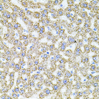 Immunohistochemistry of paraffin-embedded Rat liver using ALDH1A1 Polyclonal Antibody at dilution of 1:100 (40x lens) .