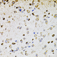 Immunohistochemistry of paraffin-embedded Mouse brain using ALDH1A1 Polyclonal Antibody at dilution of 1:100 (40x lens) .