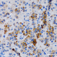Immunohistochemistry of paraffin-embedded Rat pancreas using CYP24A1 Polyclonal Antibody at dilution of 1:200 (40x lens) .