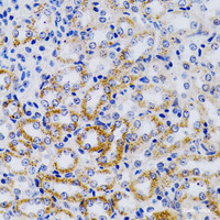 Immunohistochemistry of paraffin-embedded Mouse kidney using CYP24A1 Polyclonal Antibody at dilution of 1:200 (40x lens) .