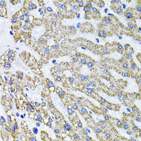 Immunohistochemistry of paraffin-embedded Human liver damage using SDC2 Polyclonal Antibody at dilution of 1:100 (40x lens) .