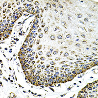 Immunohistochemistry of paraffin-embedded Human esophagus using SDC2 Polyclonal Antibody at dilution of 1:100 (40x lens) .