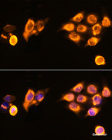 Immunofluorescence analysis of HeLa cells using ASPM Polyclonal Antibody at dilution of 1:100. Blue: DAPI for nuclear staining.