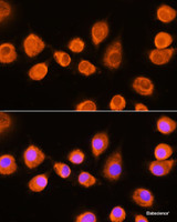 Immunofluorescence analysis of L929 cells using ASPM Polyclonal Antibody at dilution of 1:100. Blue: DAPI for nuclear staining.