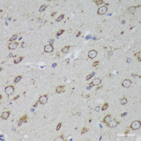 Immunohistochemistry of paraffin-embedded Rat brain using PSAP Polyclonal Antibody at dilution of 1:200 (40x lens) .