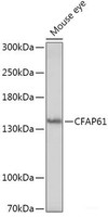 Western blot analysis of extracts of Mouse eye using CFAP61 Polyclonal Antibody at dilution of 1:1000.