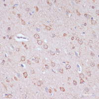 Immunohistochemistry of paraffin-embedded Rat brain using CARTPT Polyclonal Antibody at dilution of 1:100 (40x lens) .