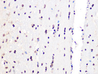 Immunohistochemistry of paraffin-embedded Rat brain using PCIF1 Polyclonal Antibody at dilution of 1:100 (40x lens) .