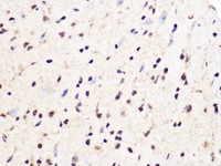 Immunohistochemistry of paraffin-embedded Mouse spinal cord using PCIF1 Polyclonal Antibody at dilution of 1:100 40x lens) .